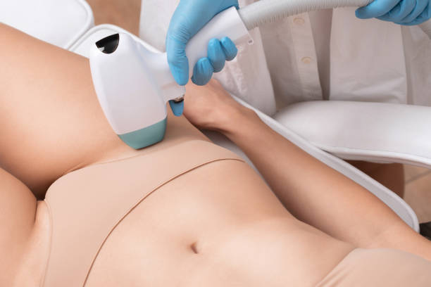 Bikini laser hair removal in Abu Dhabi