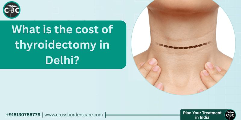 Robotic thyroidectomy in Delhi