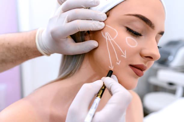 Cheek Augmentation in Abu Dhabi