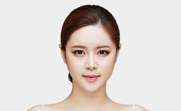 Double Eyelid Surgery in Korea