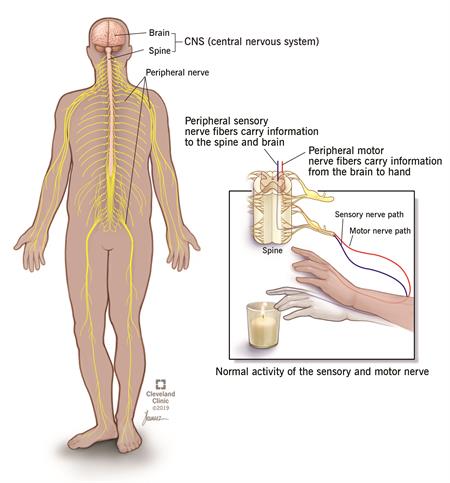 Peripheral neuropathy