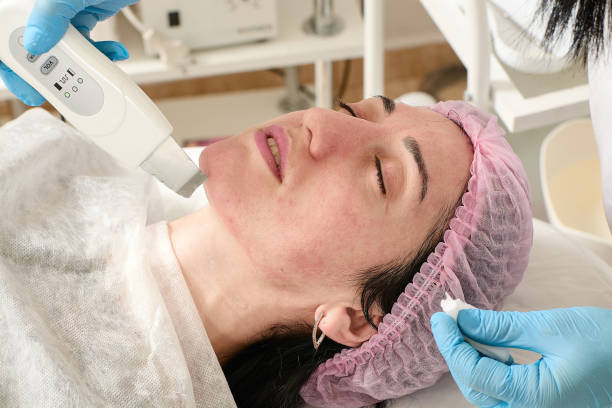 Laser acne scar treatment in Abu Dhabi