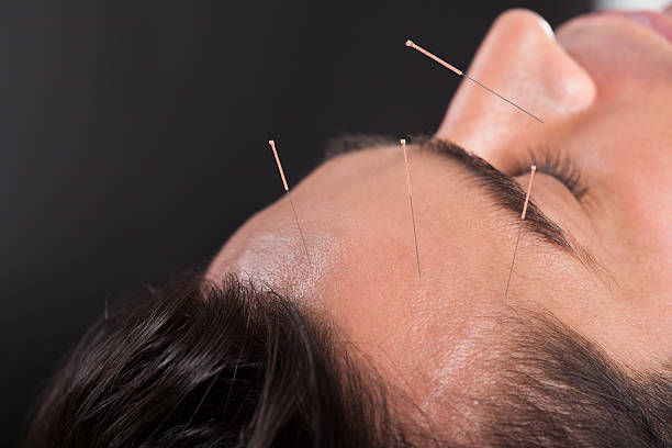 Crown Hair Transplant in Abu Dhabi