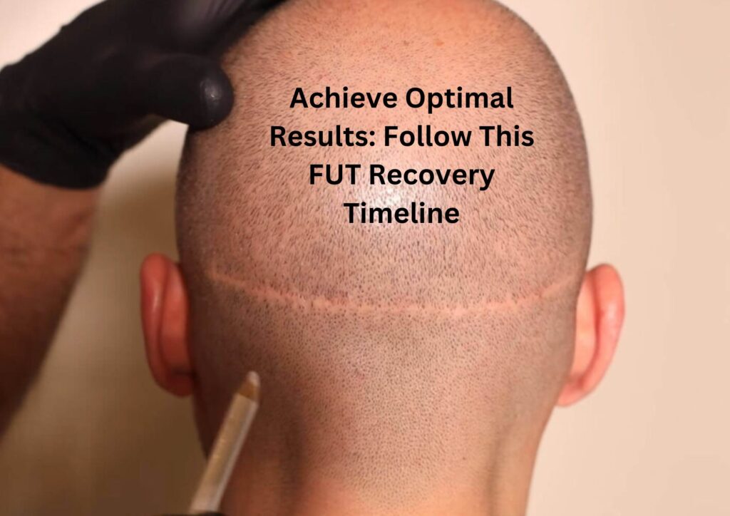 Achieve Optimal Results: Follow This FUT Recovery Timeline