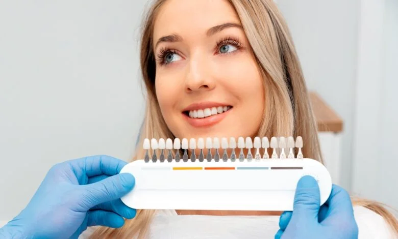 cosmetic veneers in Roslindale