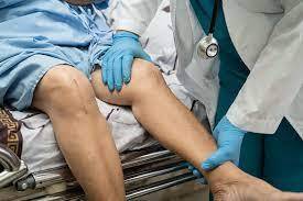 The Different Types of Hip and Knee Surgery Available in Karachi