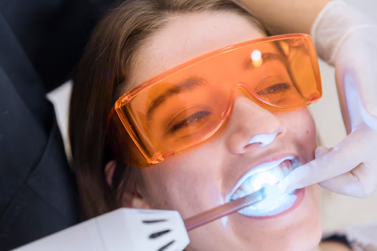 teeth whitening jasper al