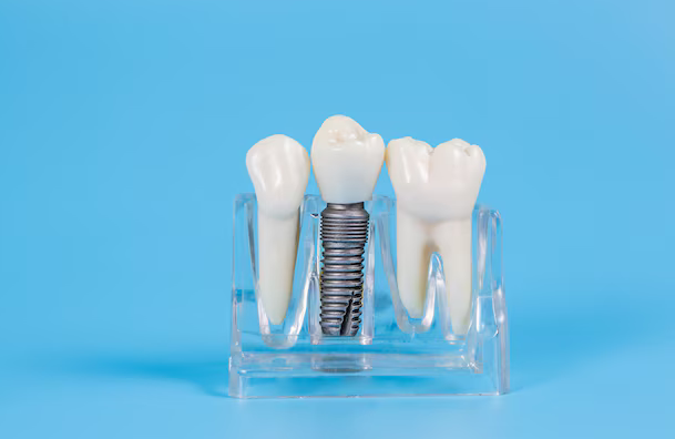 implant dentistry bowling green ky