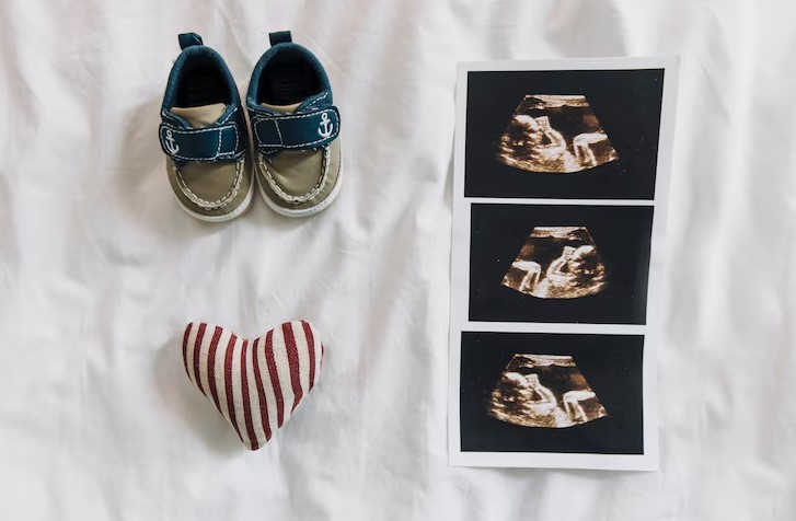 Gender Reveal Ultrasound
