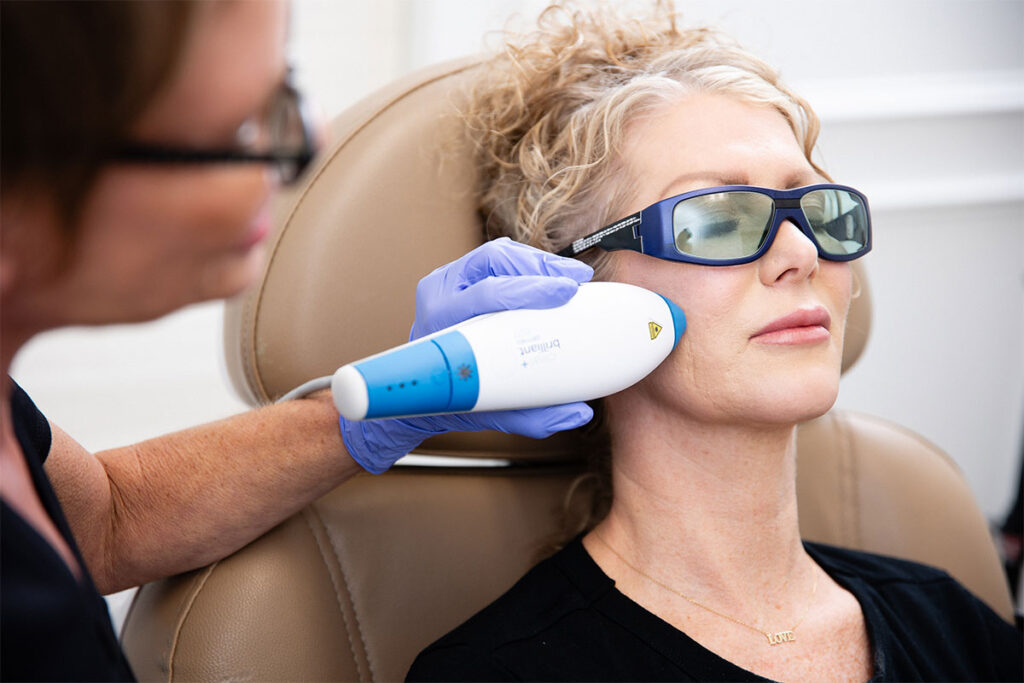 Laser Facial Treatment Daytona Beach/Laser For Melasma Daytona Beach