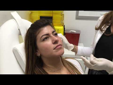 Paradeplatz Botox – Effektive Faltenbehandlung in Zürich