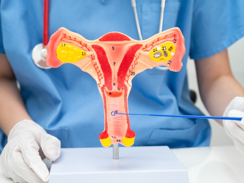 Fibroid Embolization