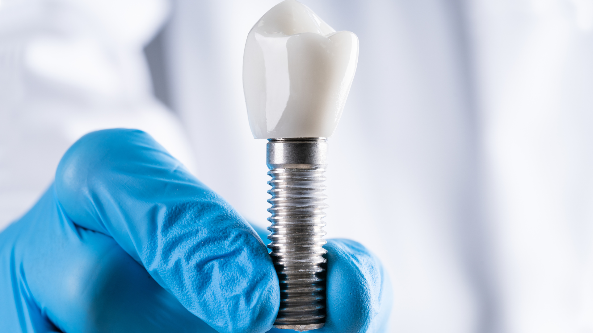 Hutt Dental Implant Centre provides specialist dental implant care in Lower Hutt, offering personalised treatment plans, advanced digital technology, and complete implant solutions under one roof.