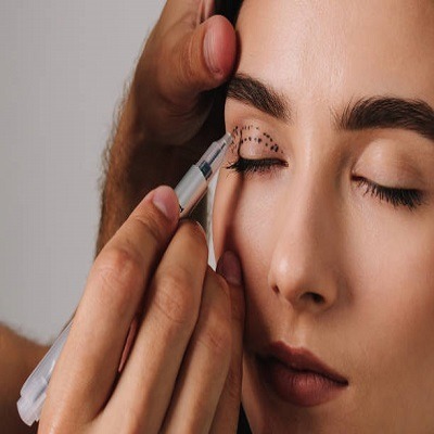 Eyelid Surgery in Riyadh 9