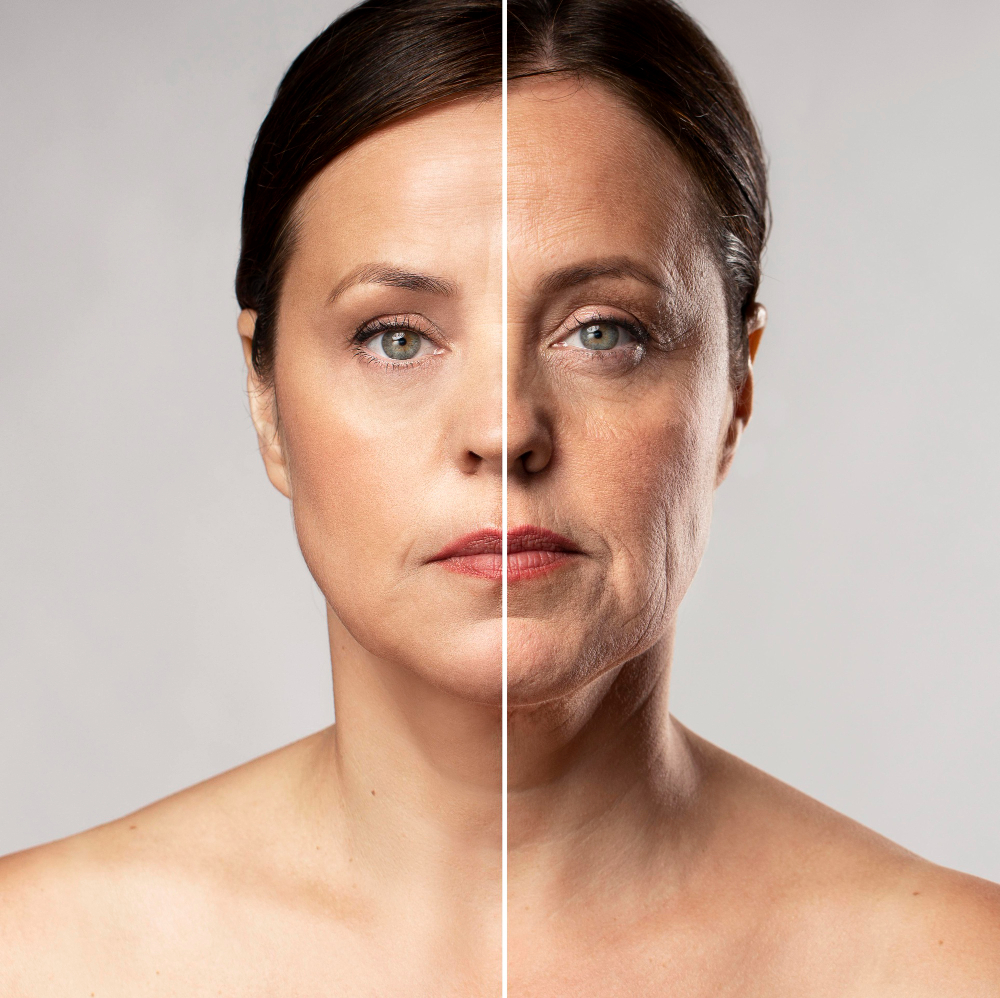 face lifting treatment