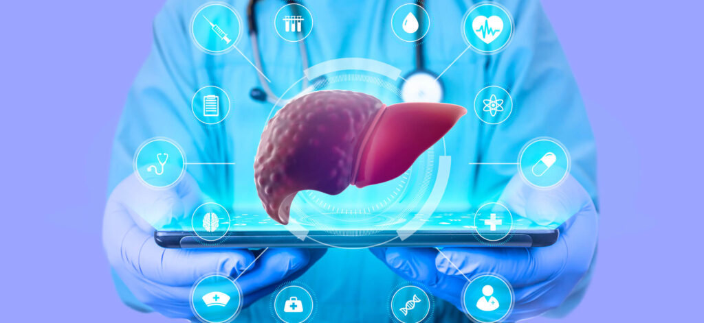 cirrhosis