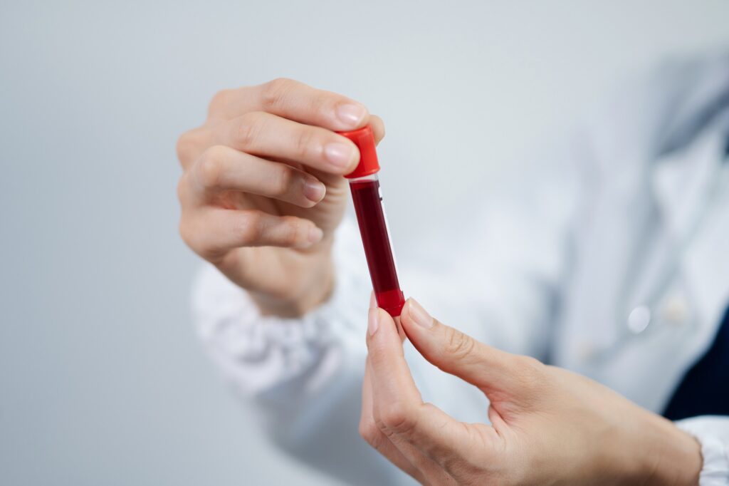 routine blood tests